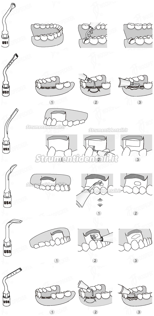 Woodpecker® Inserti Pizeo Osteotomia Chirurgia Kit 6 Inserti